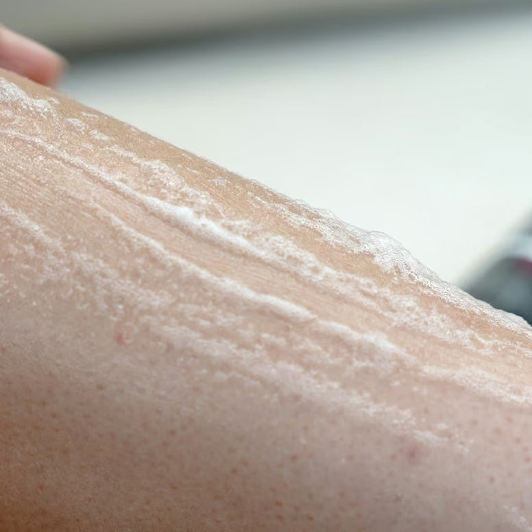 Dynamic Rapid Recovery